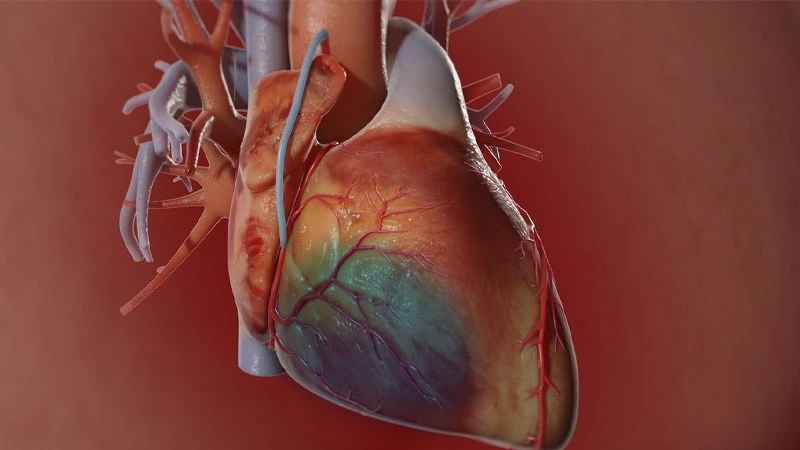 An Illustration of coronary artery
surgery
