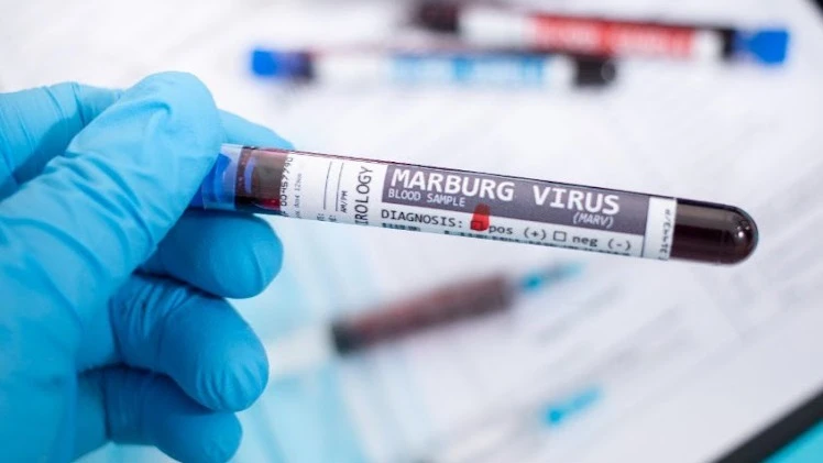 In March 2023, Tanzanian health authorities announced that an outbreak of Marburg viral disease that had killed five people in Kagera Region was under control.