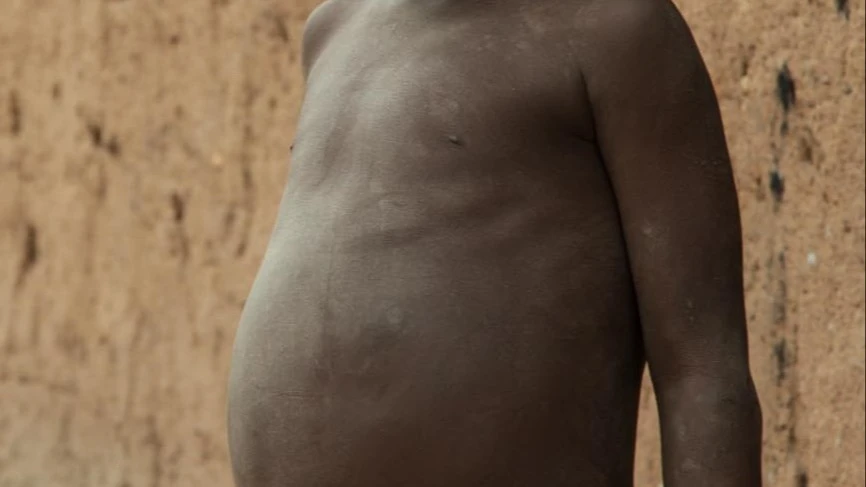 Ni aibu mikoa hii  kutajwa udumavu